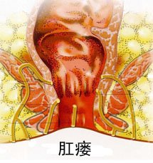 ��������ʹ����