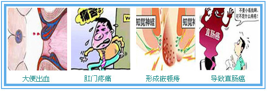 ���̴�Ӱ����������