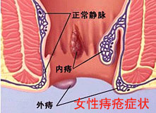 ���̼��Ҫ����Ǯ