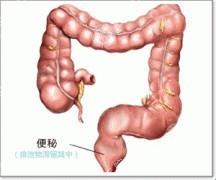 �ű����ѵ���Ϻ�����