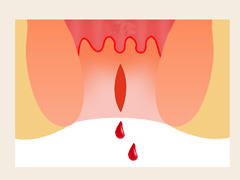 �̴���Ѫ��ʲôҩ