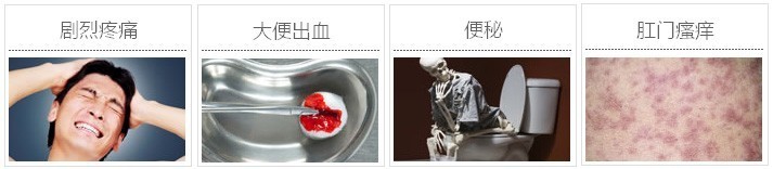 肛裂治疗的费用要多少