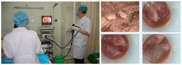 ������Χ������ô��