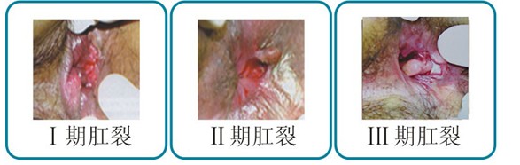 ��������ô����