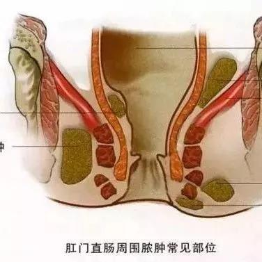 ����ŧ����ô�죿�񻯳ɸ������ʸ���